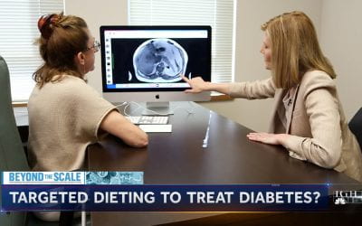 Diet Treatment for Type 2 Diabetes