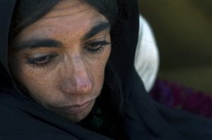 A photo of a woman crying. Her face is bruised. 