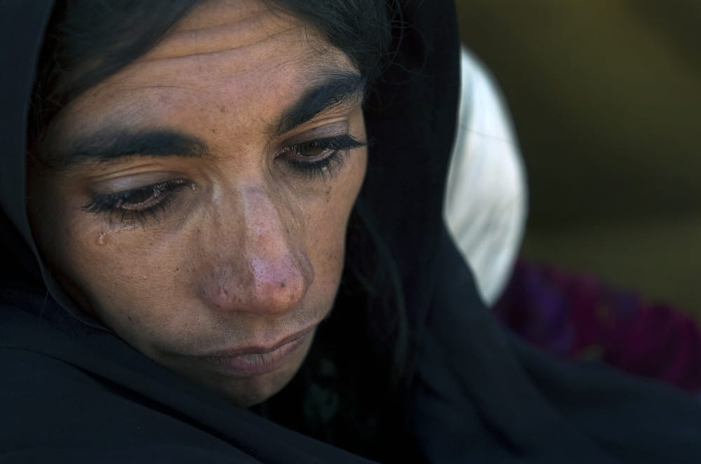 Photo of a woman crying. Her face is bruised.