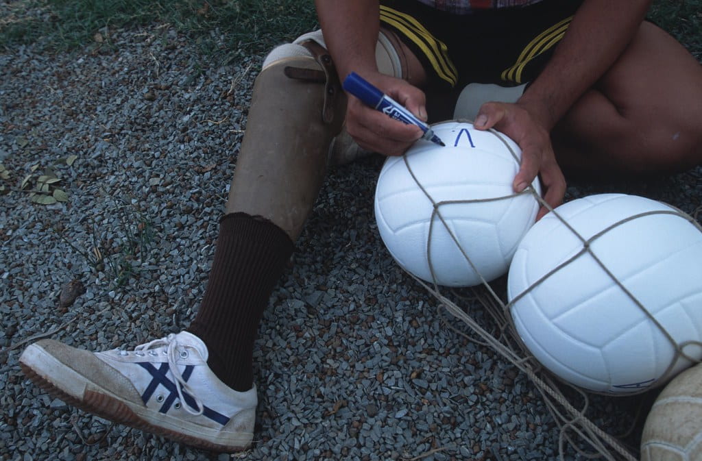 The image shows a man with a prosthetic leg sitting on the ground. In his hand is a volleyball, on which he is writing something with a marker. 