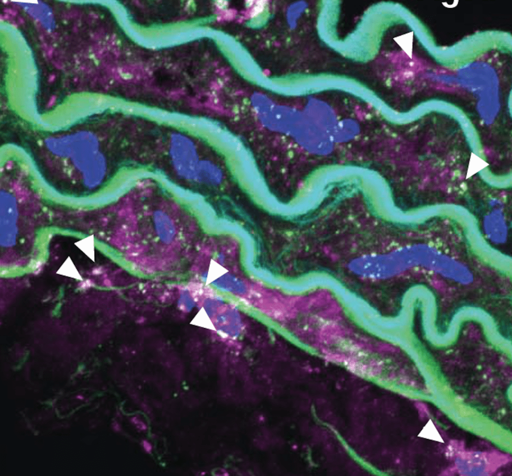 immune fluorescence image of mouse aorta